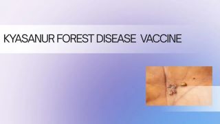 Human trials of an advanced vaccine against Kyasanur Forest Disease (KFD) begin